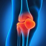 Glucosamine-Knee-Physiotherapy-in-Oakville